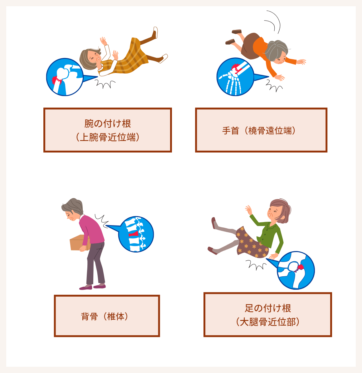 骨粗鬆症とは｜FLS college ～二次骨折ゼロを目指して、私たちが